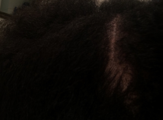 Francin's African Hair Braiding - Herndon, VA. Bald spot from pulling my hair when they braided it