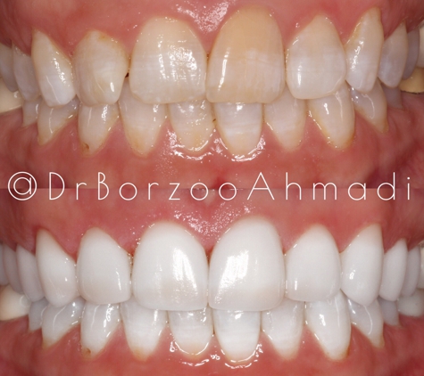 Dr. Borzoo Ahmadi DDS - West Hollywood, CA