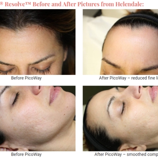 Helendale Dermatology & Medical Spa - Rochester, NY