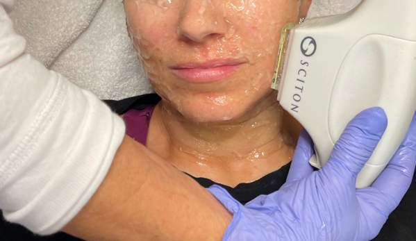 Wellspring Skincare - Roswell, GA. BBL Laser at Wellspring Skincare