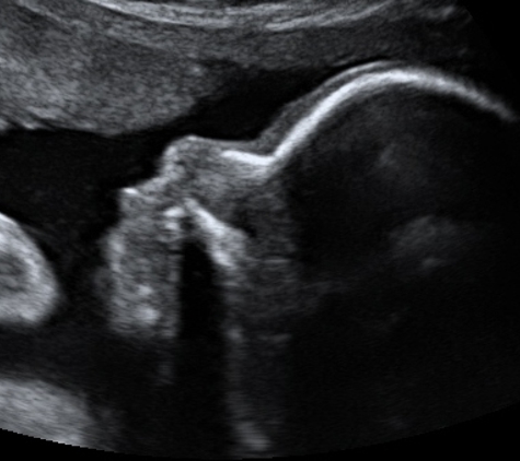 TLC Imaging 3D/4D Ultrasounds - Reynoldsburg, OH