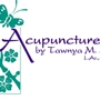 Acupuncture By Tawnya Salas