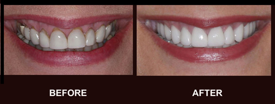 Cosmetic Dentist In Shenandoah Baton Rouge Louisiana LA