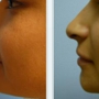 Plastic Surgery Center of Glendora - Dr. Jon I Sattler, MD