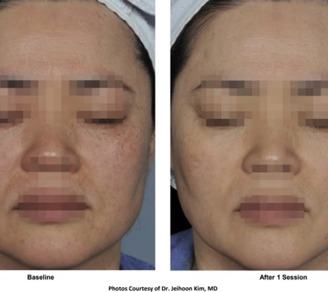 Clean Laser Clinics - Teneriffe, QLD