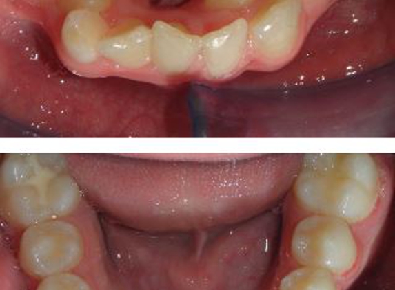Glenn Carty Orthodontist - Gungahlin, ACT