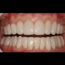 Advanced Dentistry of Amarillo - Cosmetic Dentistry