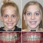 Horner Barrow Orthodontics PC