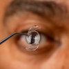 Center for Advanced Eye Care - Carty Eye gallery