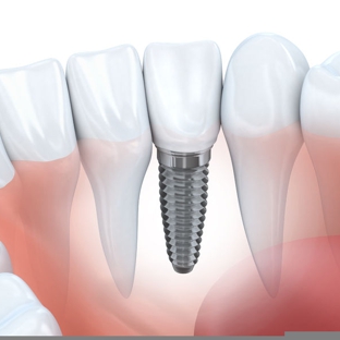 West Preston Dental - Preston, VIC. http://www.westprestondental.com.au
