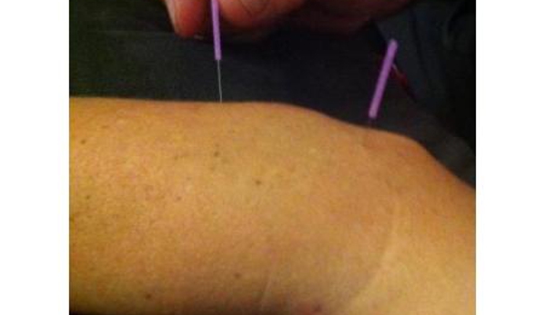 Back Into Action Osteopathic Group - Macleod, VIC