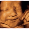 4D Moments Ultrasound LLC gallery