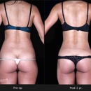 bodySCULPT® - Physicians & Surgeons, Plastic & Reconstructive