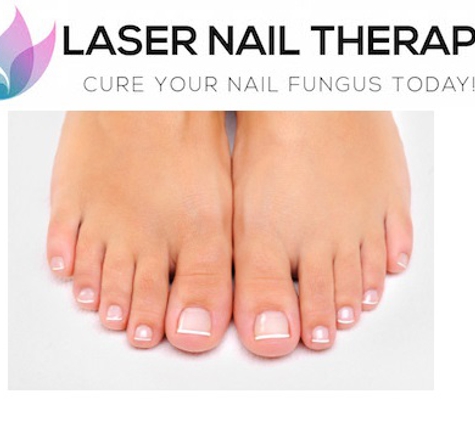 Laser Nail Therapy - San Diego, CA