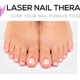 Laser Nail Therapy