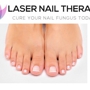 Laser Nail Therapy Clinic--Toenail Fungus Treatment Glendale