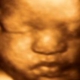 1st Glimpse Inc. 3D/4D Ultrasound