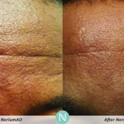 Nerium International - Team Pratt