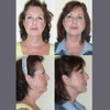 The Brandow Clinic Plastic Surgery - Kirk Brandow, MD gallery