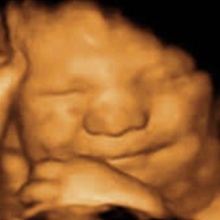 Mommy2Bee 4D Ultrasound - Hahira, GA