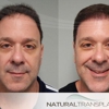 Natural Transplants Hair Restoration Clinic gallery