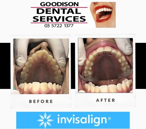Goodison Dental Services Pty Ltd - Wangaratta, VIC