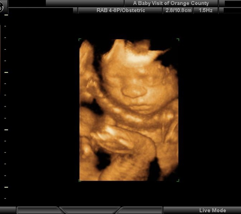 A Baby Visit 4D Ultrasound - Orange, CA