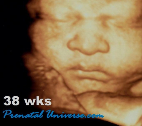 Prenatal Universe Ultrasound - Tacoma, WA