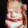 Bundle of Love 3D/4D 5D HDLive Ultrasound & Baby Boutique gallery