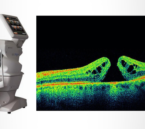 Somerville & Merrin Optometrists - East Toowoomba, QLD. Using The Latest Technologies To Diagnose & Manage Eye Conditions
