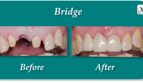 TLC Dental - Murrieta, CA