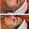 Reveil Beauty Esthetics gallery