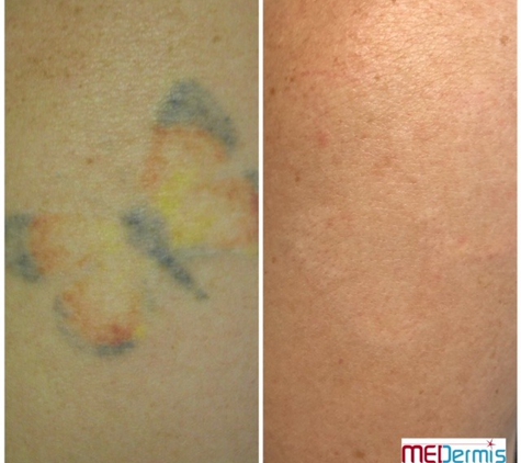 MEDermis Laser Clinic - San Antonio - San Antonio, TX