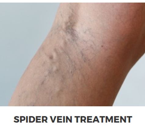 Vein Health Clinics - Oviedo, FL