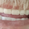 Affordable Dentures & Implants gallery