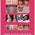 AAA Jewelry,ear piercing,laser tattoo removal...