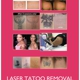 AAA Jewelry,ear piercing,laser tattoo removal...