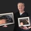 Arocha Hair Restoration gallery