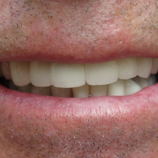 All-In-One Dental Montrose - Dr. Daniel Hatch - Montrose, CO