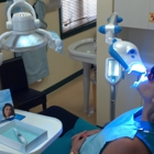 Smile Labs Teeth Whitening