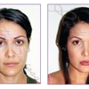 Ruth Swissa Permanent Make-Up And Skin gallery