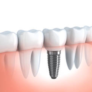 Jones Dental - Wollongong, NSW