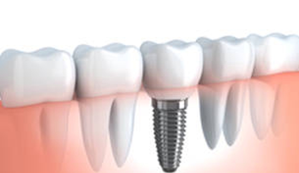 Jones Dental - Figtree, NSW