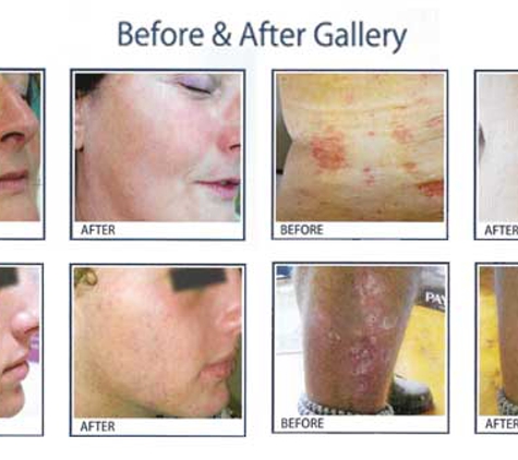 MP Spa & Beauty - East Maitland, NSW. Rej And Rejuvenation