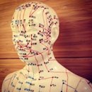 Healing Foundations - Acupuncture