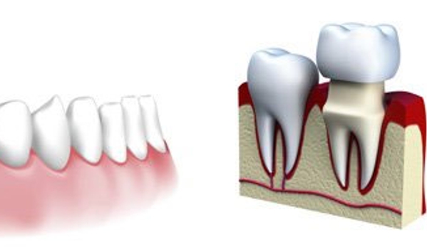 Rowville Dental Surgery - Rowville, VIC