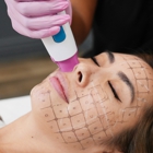 LaserAway Summit