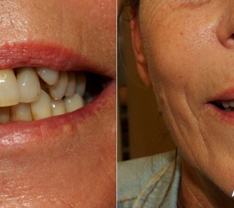 Mudgeeraba Denture Clinic - Mudgeeraba, QLD
