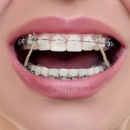 Smile Ranch Orthodontics - Orthodontists