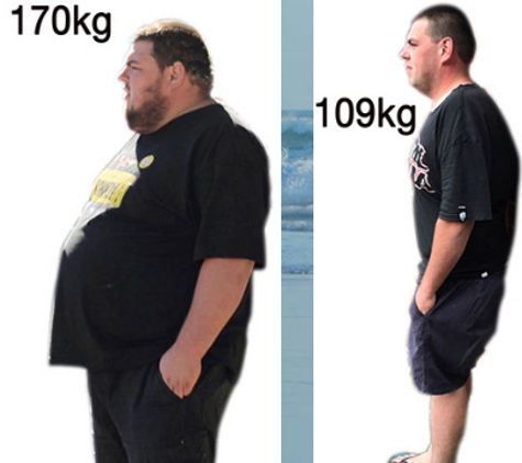 Bowral Bariatric Centre - Bowral, NSW